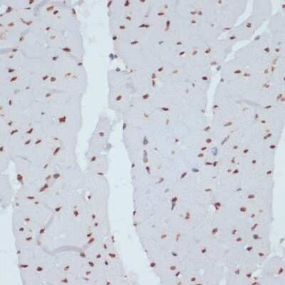Immunohistochemistry-Paraffin: Chk1 [p Ser280] Antibody - Azide and BSA Free [NBP3-05379]